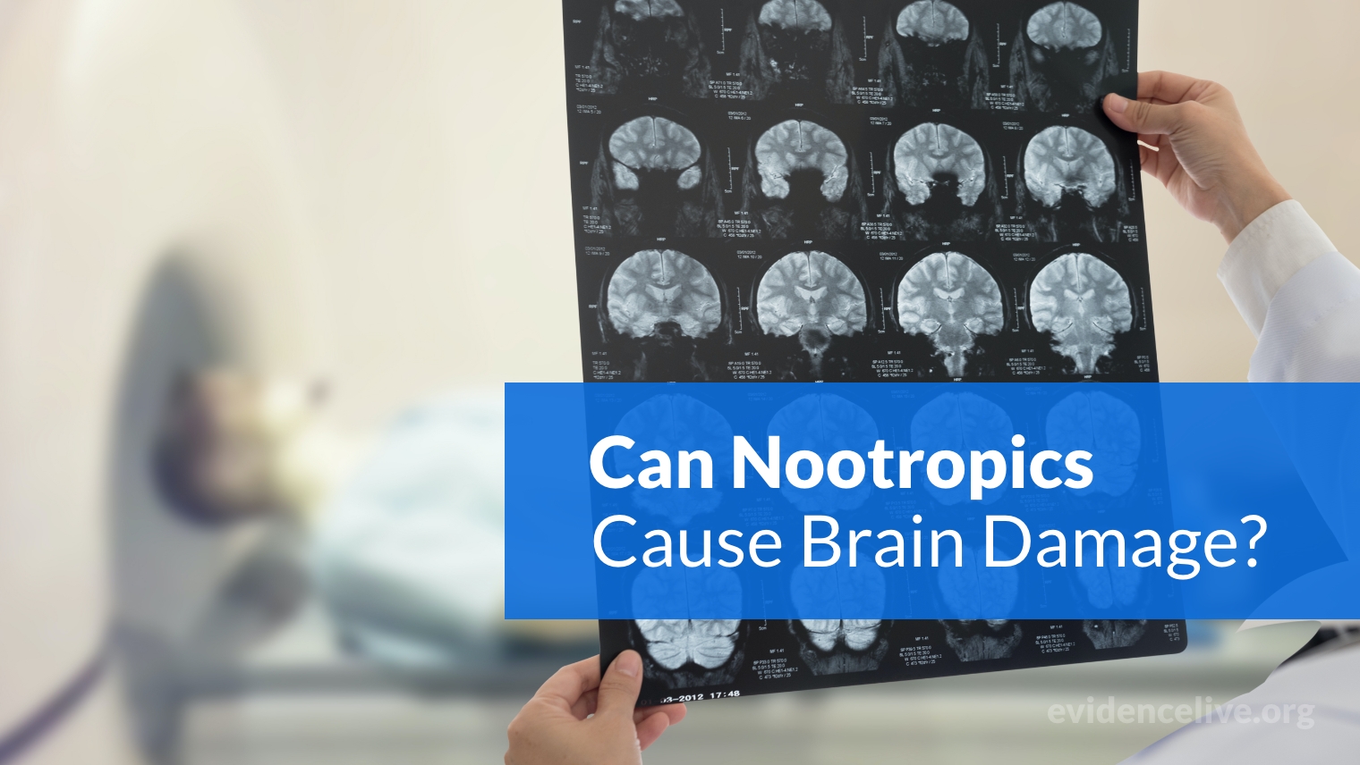 Can Nootropics Cause Brain Damage?