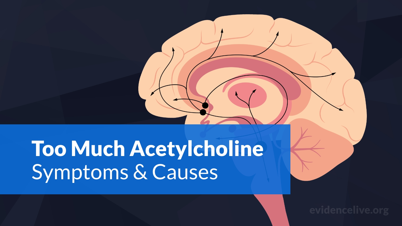 Too Much Acetylcholine: Symptoms and Causes of High Levels